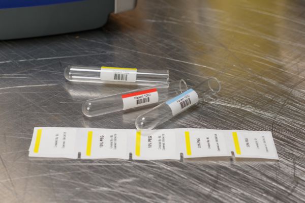 Identyfikacja laboratoryjna w dobie koronawirusa